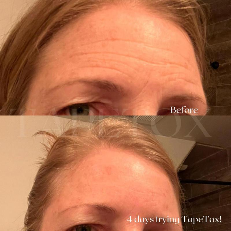 TapeTox Natural Wrinkle Smoothers