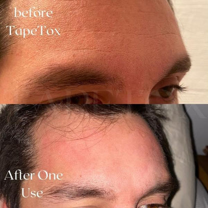 TapeTox Natural Wrinkle Smoothers